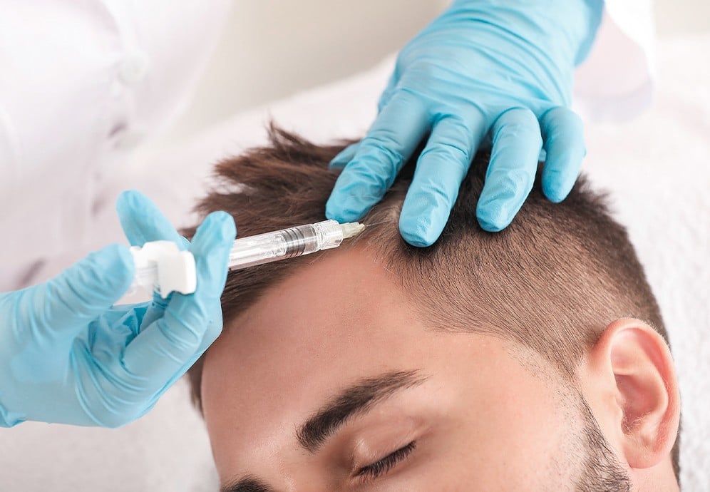 Mésothérapie cheveux - Le Centre de greffes de cheveux Paris Trocadéro