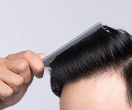 Greffe de cheveux technique | Centre de Greffe de cheveux