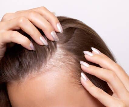 Micro greffe capillaire | Centre de Greffe de cheveux